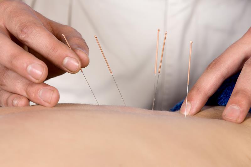 Acupuncture Bohemia, NY 